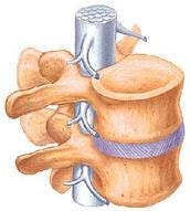 Anatomical illustration of the spine and nervous system showing vertebrae and nerve connections
